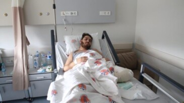 Kardeşi için ayağını kaybetti