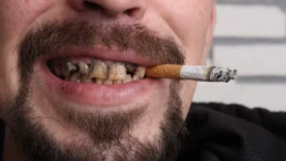 Sigara, Diş Eti Sağlığını Olumsuz Etkiliyor