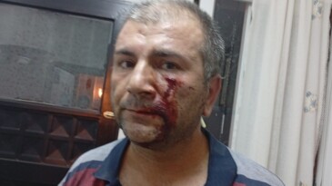 MAHALLELİDEN DAYAK YEDİ