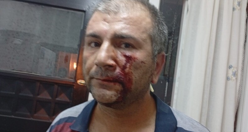 MAHALLELİDEN DAYAK YEDİ