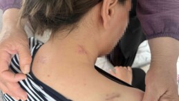 17 bıçak darbesi aldı, ölü numarasıyla kurtuldu, kocasının en ağır cezayı almasını istedi