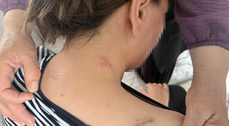 17 bıçak darbesi aldı, ölü numarasıyla kurtuldu, kocasının en ağır cezayı almasını istedi