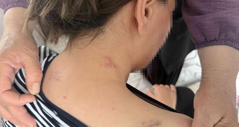 17 bıçak darbesi aldı, ölü numarasıyla kurtuldu, kocasının en ağır cezayı almasını istedi